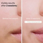 لیزر بدن براون مدل Silk-expert Pro 5 PL5146 4